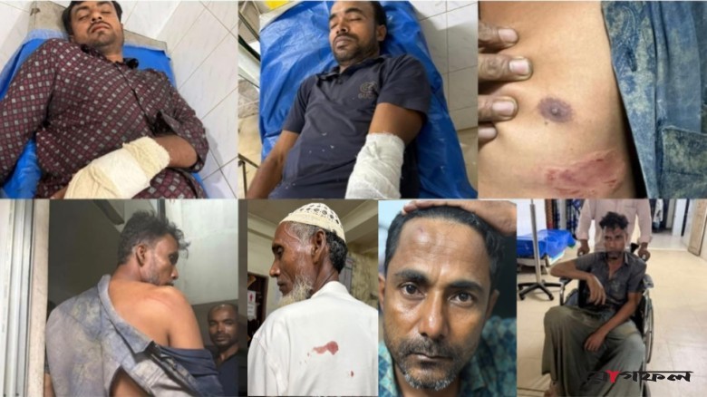 উখিয়ায় উচ্চস্বরে গান-বাজনা করা'কে কেন্দ্র করে সংঘর্ষ